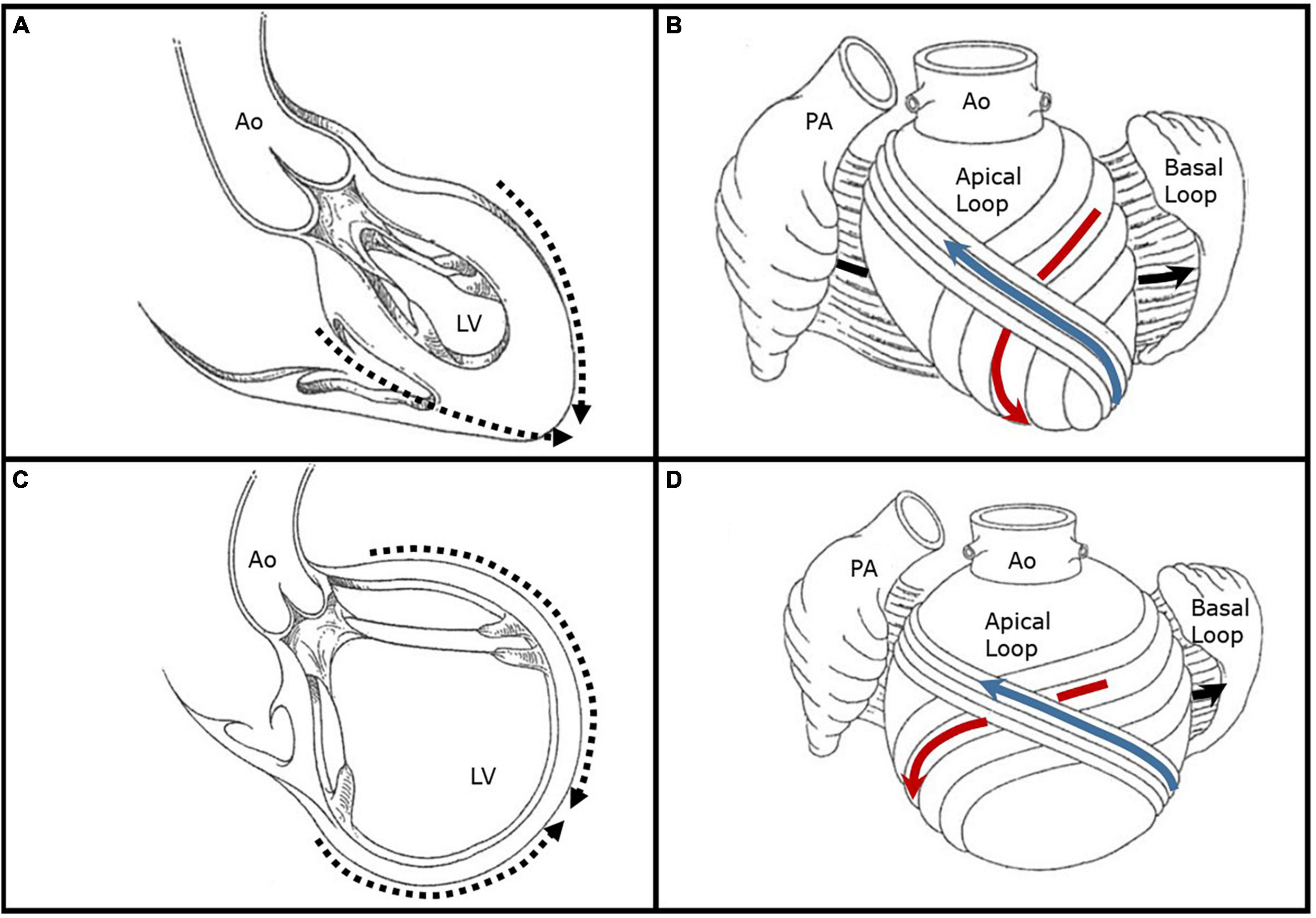 Left ventricular remodeling, mechanics, and the COAPT trial
